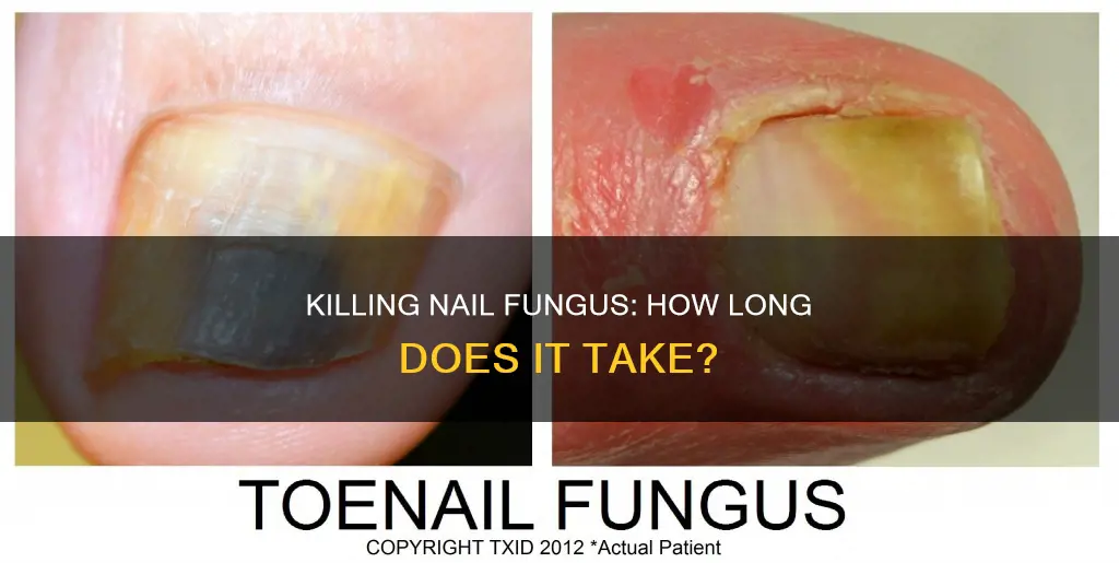 how long to kill nail fungus