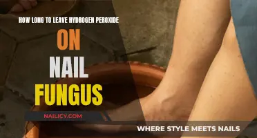 Hydrogen Peroxide Treatment for Nail Fungus: How Long?