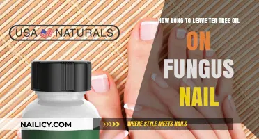 Tea Tree Oil Treatment for Fungal Nails