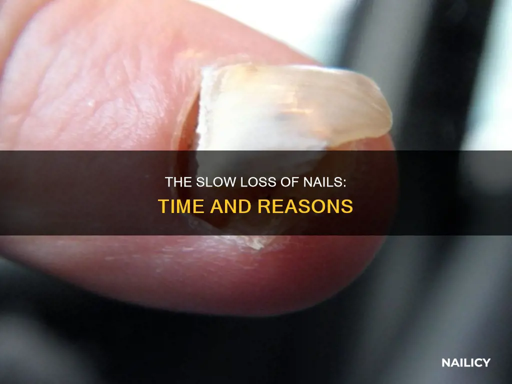 how long to lose a nail