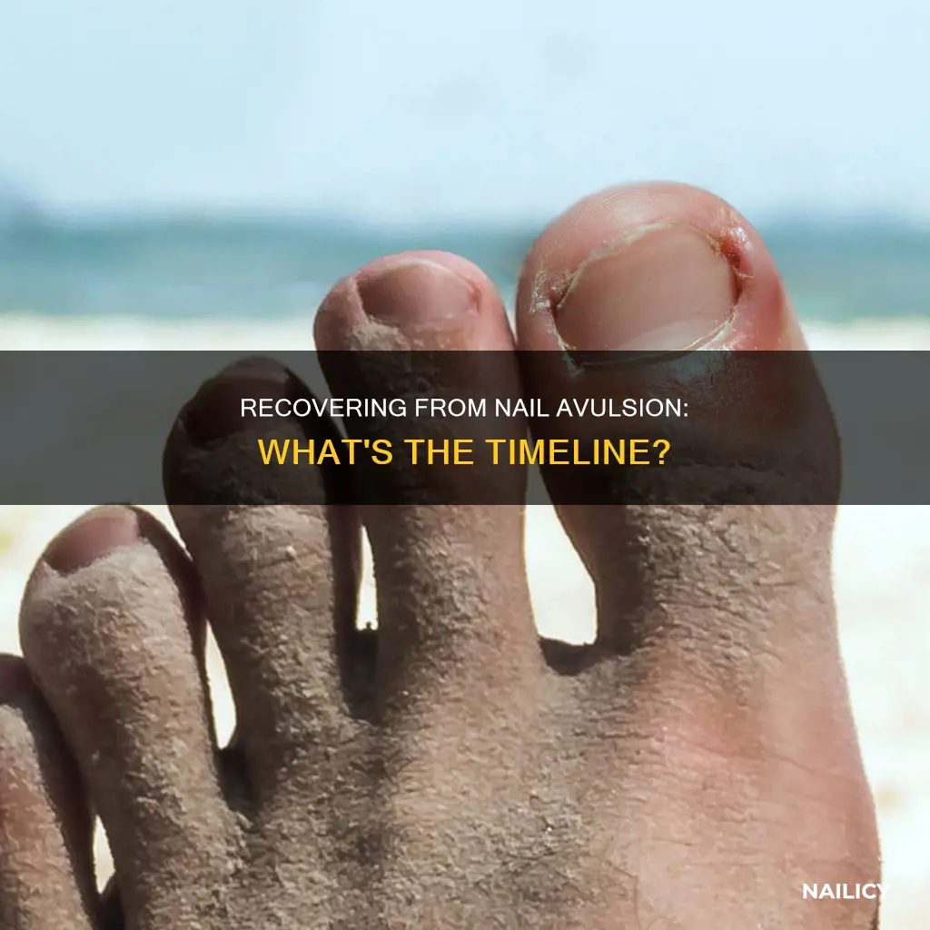 how long to recover from nail avulsion