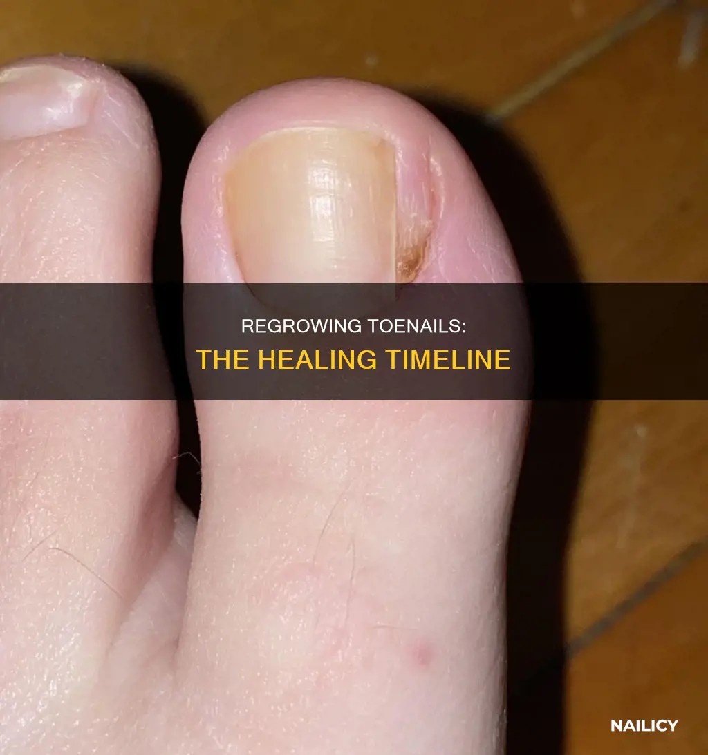 how long to regenerate toe nail