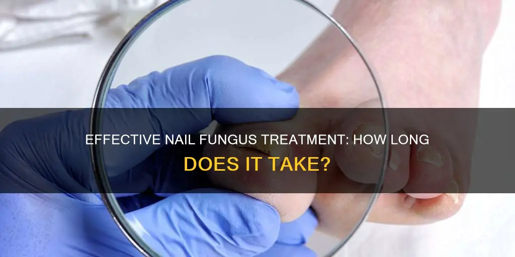 how long to repair nail fungus treatment