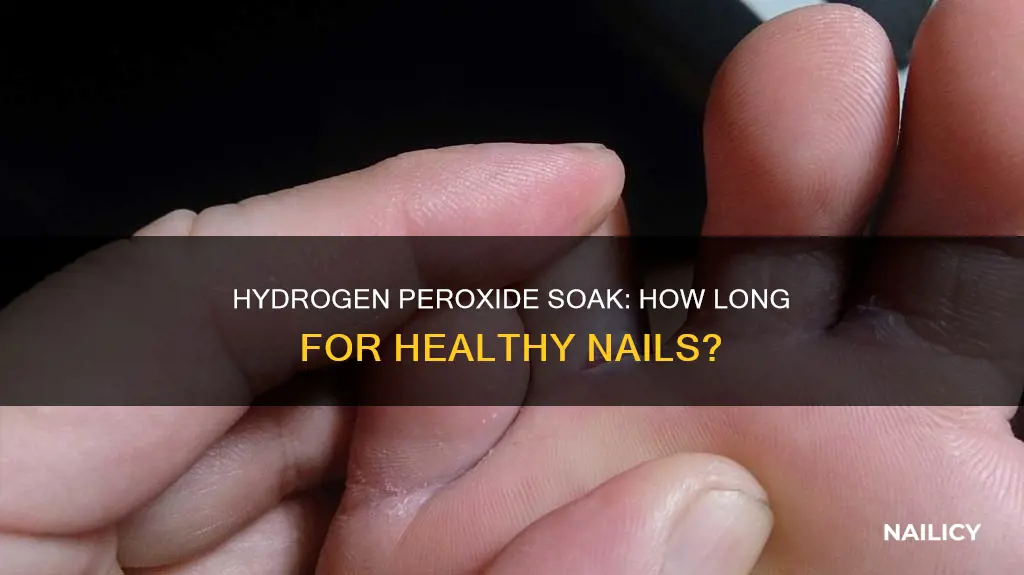 how long to soak nails in hydrogen peroxide