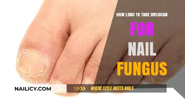 Diflucan Treatment for Nail Fungus: How Long Does It Take?