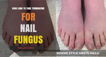 Treating Nail Fungus: How Long Does Terbinafine Take?