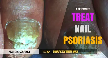 Effective Treatment for Nail Psoriasis: How Long Does It Take?