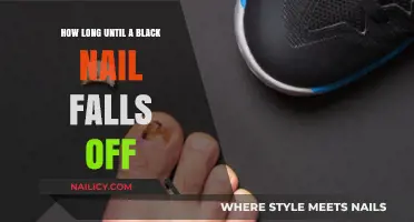Black Nail Trauma: The Long Wait for Recovery