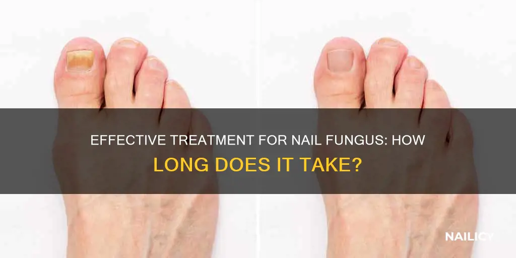 how long until nail fungus goes away