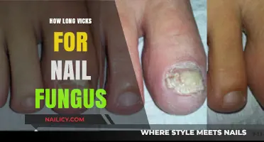 Vicks for Nail Fungus: How Long to Apply?