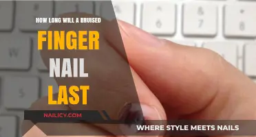 Bruised Fingernail: How Long Will It Last?