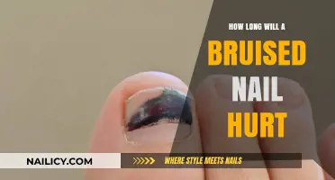 Bruised Nail Pain: How Long Does It Last?