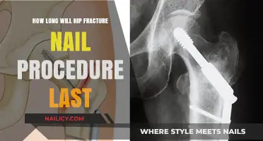 Hip Fracture Nail Procedure: How Long Will It Last?