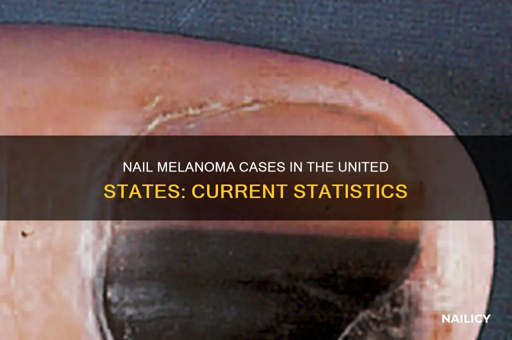 how many cases of nail melanoma united states
