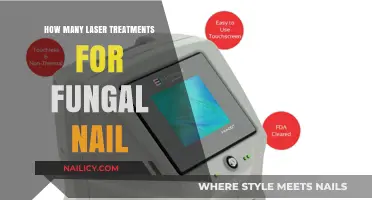 Effective Laser Treatment Sessions for Fungal Nail Infections: What to Expect