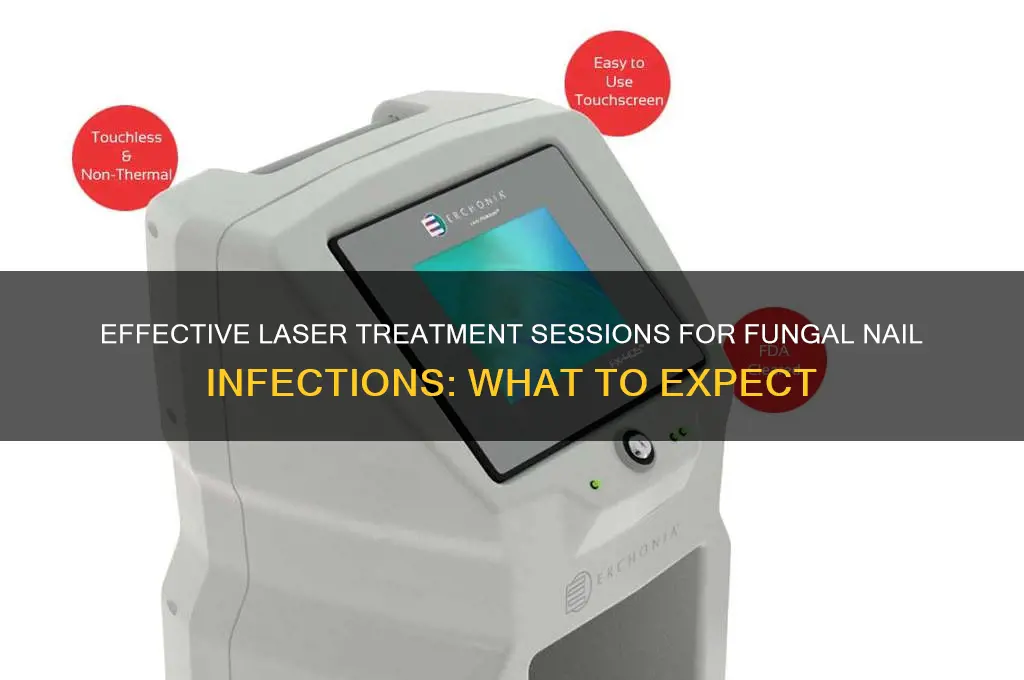 how many laser treatments for fungal nail