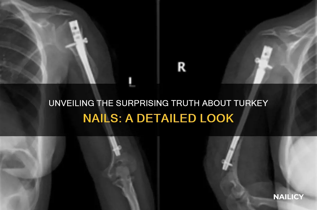 how many nails does a turkey have