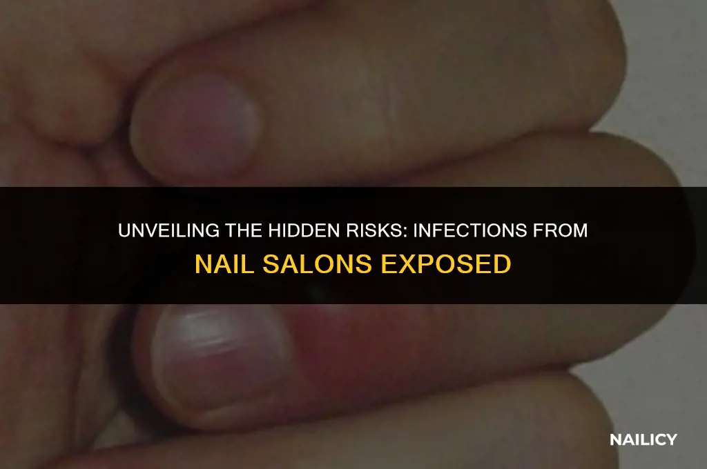 how many people get infections from nail salons