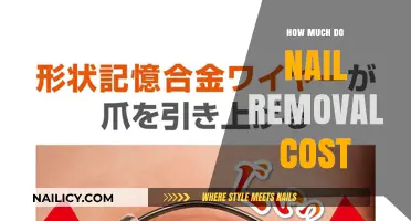 Nail Removal Cost: What's the Price of Pretty?