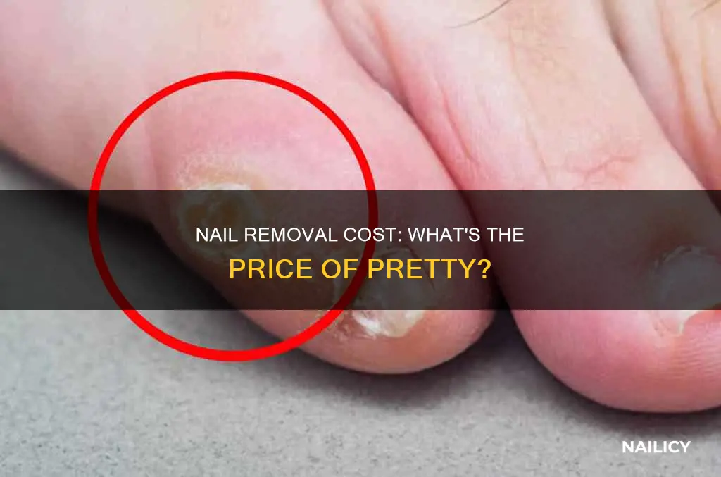 how much do nail removal cost