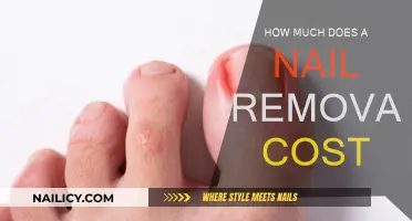 Nail Removal Cost: How Much Does It Really Cost?