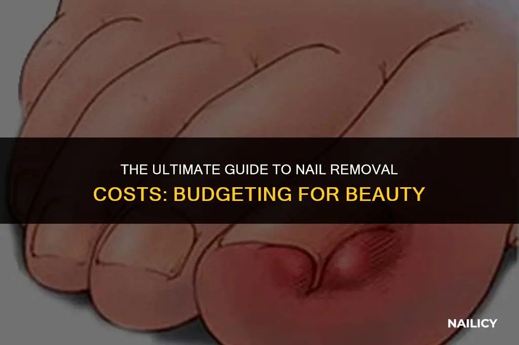 how much does it cost to get nails off