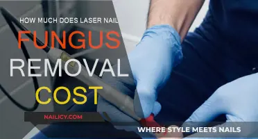 Laser Nail Fungus Removal: Cost and Effectiveness