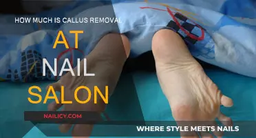Callus Removal Cost at Nail Salons: How Much?