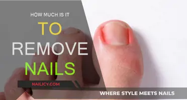 Affordable Nail Removal Services: Cost and Benefits