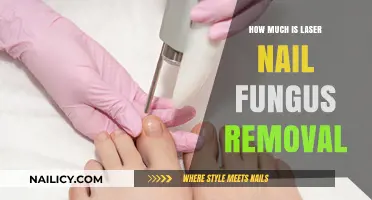 Laser Nail Fungus Removal: Cost and Effectiveness