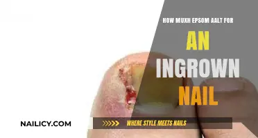 Effective Epsom Salt Soak Remedies for Treating Painful Ingrown Toenails