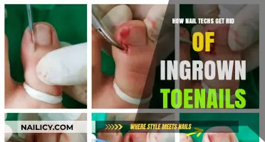 Effective Ways Nail Techs Eliminate Ingrown Toenails