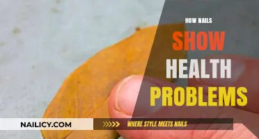 Nail Health Clues: Uncovering Hidden Signs of Wellness Issues
