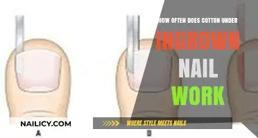 Does Cotton Under Ingrown Nail Work? Frequency and Effectiveness Explained