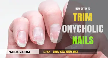 Trimming Onycholic Nails: How Often Should You Clip?