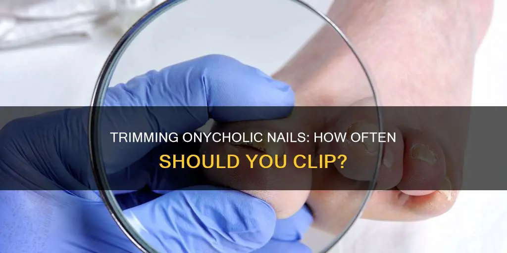 how often to trim onycholic nails