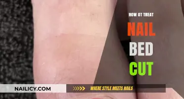 Treating Nail Bed Cuts: Quick and Easy Home Remedies