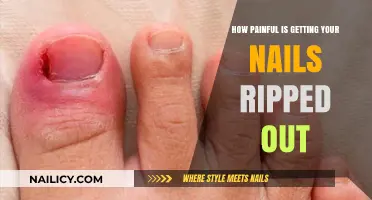 The Agonizing Truth: Nail Removal Pain Explained