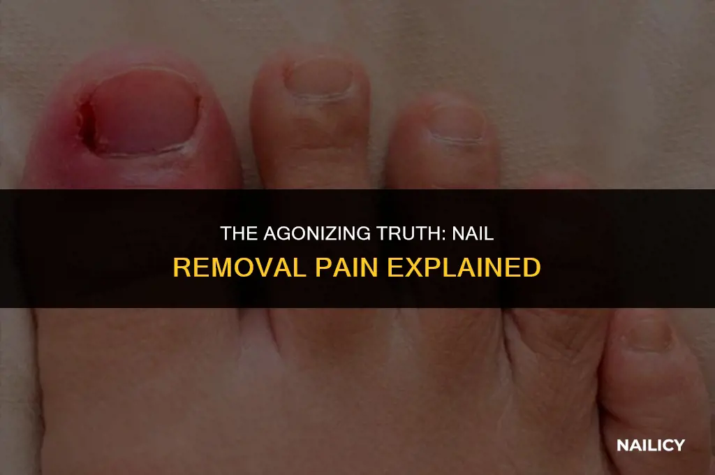 how painful is getting your nails ripped out