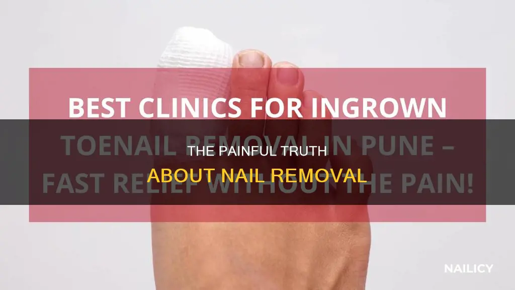 how painful is it to remove nail