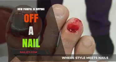 The Agonizing Truth: Ripping Off a Nail Pain Explained