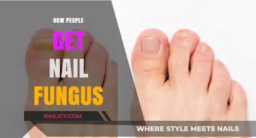 Understanding Nail Fungus: Causes and Prevention Tips