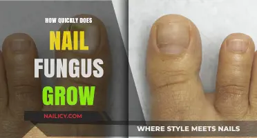 Nail Fungus: Rapid Growth and Treatment Options