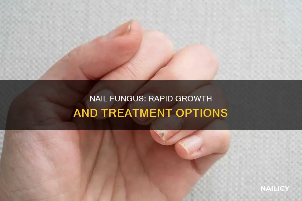 how quickly does nail fungus grow