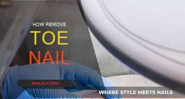 Toe Nail Removal: A Step-by-Step Guide