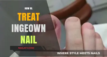 Effective Remedies for Treating Ingrown Nails with RL Techniques