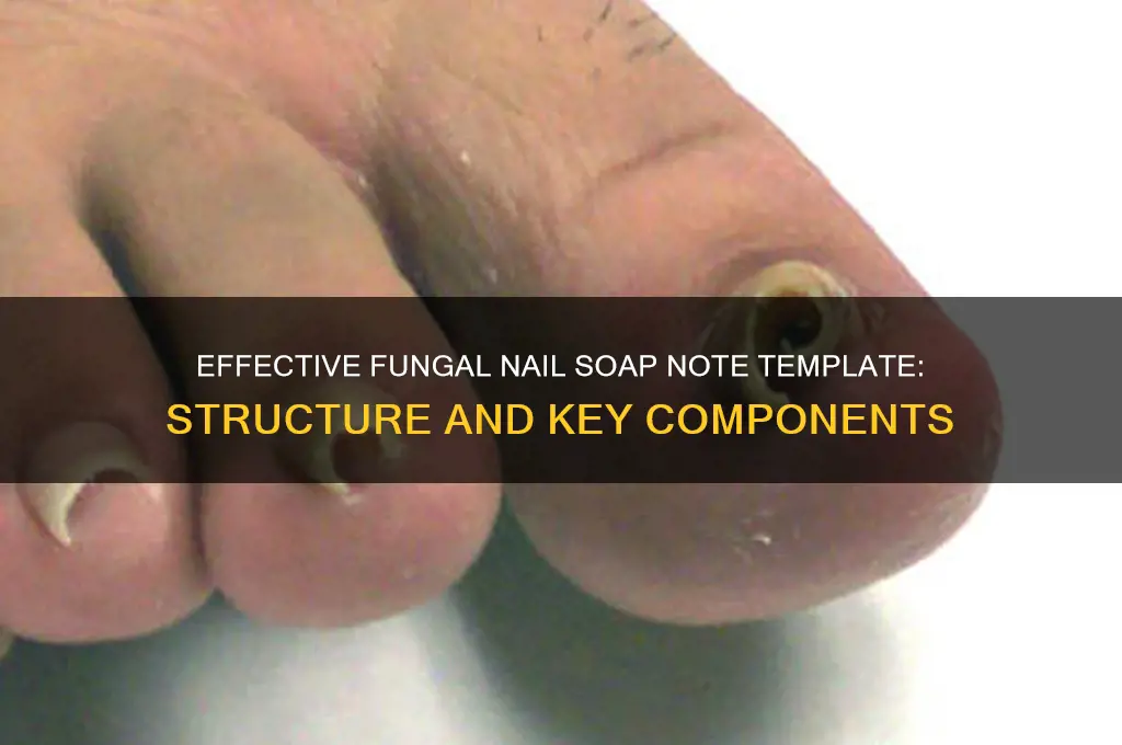 how should a fungal nail soap note template