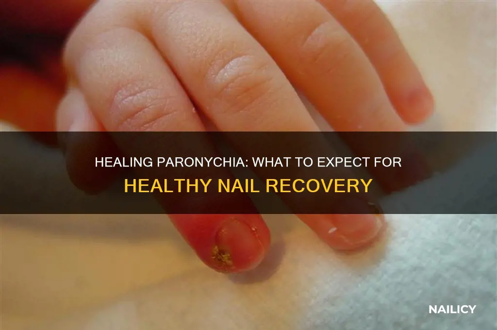 how should my nail look healing from paronychia