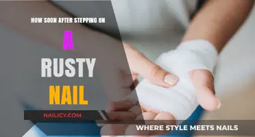 Rusty Nail Injury: How Soon Should You Seek Medical Attention?
