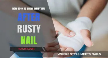 Rusty Nail Injury: When to Expect Symptoms and Seek Treatment